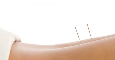 Benefits of Acupuncture